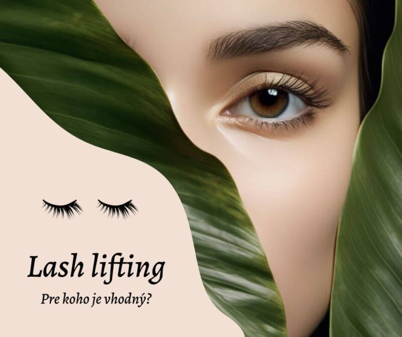 Lash lifting - všetko o kozmetickom ošetrení, vrátane výhod a nevýhod